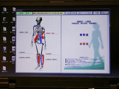 姿勢分析システムによる歪み検査